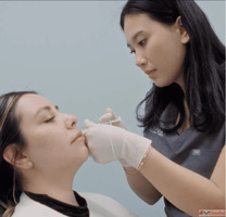 Best Derma Fillers Treatment - Radiance Aesthetic Medicine