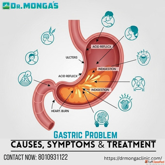 Stomach ulcer doctor in Bhajan Pura