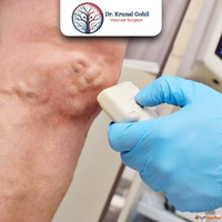 Advanced Care for Vascular Injuries by a Trusted Vascular Sp...