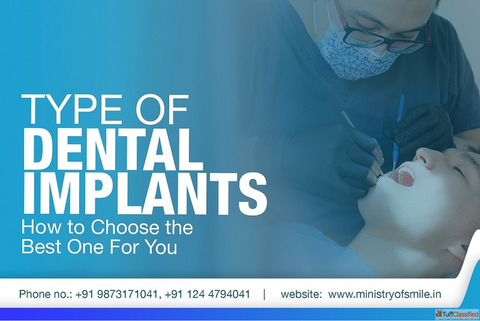 Dental Implants in Gurgaon