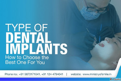Dental Implants in Gurgaon