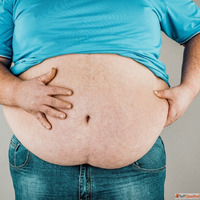 Expert Care from the Best Obesity Surgeon in India