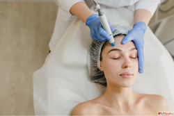 Morpheus8 Skin Tightening in Delhi - Redefine Your Skin at I...