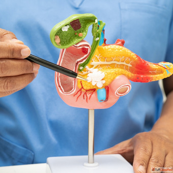 Expert Surgical Solutions for Best Pancreatic Surgeon in India