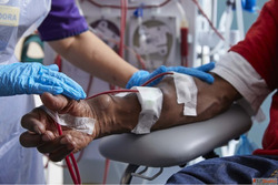 Best AV Fistula Treatment in Mumbai India by Dr Dharav Khera...
