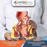 Get Treated by the Best Fissure Doctor in Ahmedabad - Gastro...