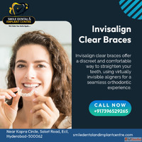 Invisalign Treatment Cost in Hyderabad Telangana