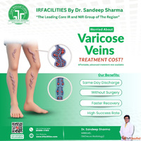 Understanding Varicose Veins Treatment Cost in India What Yo...