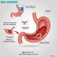 Lady doctor for stomach pain in Ghazipur