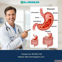 Stomach ache doctor in Gandhi Nagar