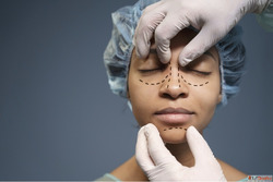 Expert Rhinoplasty in Lucknow by Dr. Sumit Malhotra