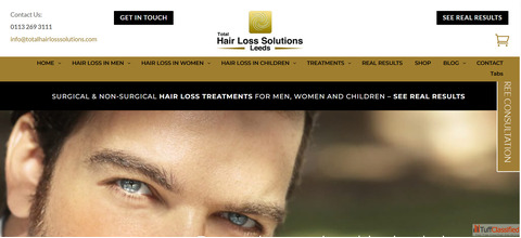PRP Treatment in Yorkshire