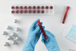 Book Accurate Blood Test Reports - Visit Ultrascan Indore