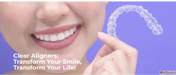 Invisible Braces Near You Find Clear Aligners in Your City -...