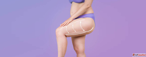 What Is a Thigh Lift Surgery