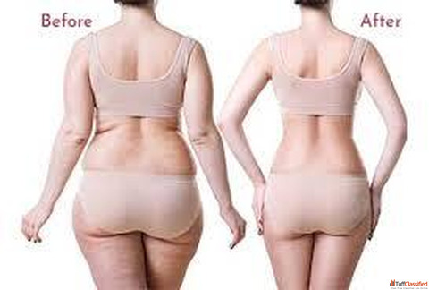 Best Body Contouring Treatment in Gurgaon Dr. Amit Gupta