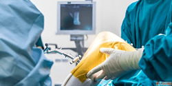 Dr. Ajaysinh Devda - Revision Total Knee Joint Replacement S...