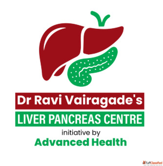 Effective Pancreatitis Treatment Expert Care at Advanced Health