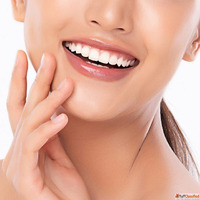 Gum Depigmentation in Dubai