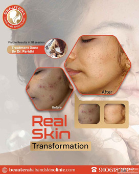 Consult the Best Skin Specialist in Kandivali Best dermatologist in Kandivali