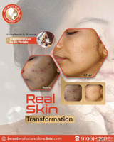 Consult the Best Skin Specialist in Kandivali Best dermatolo...