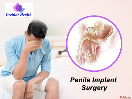 Affordable Penile Implant Surgery Cost in Bangalore at Orchidz Health