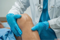Dr. Ajaysinh Devda - Complex Knee Joint Replacement Surgery ...