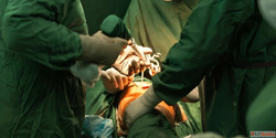 Dr. Ajaysinh Devda - Complex Hip Joint Replacement Surgery i...