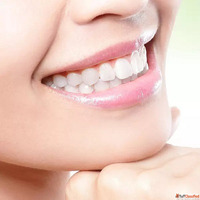 Teeth Whitening Cost in Dubai