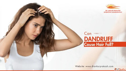 Hair Fall Due to Dandruff Find Out the Root Cause Today