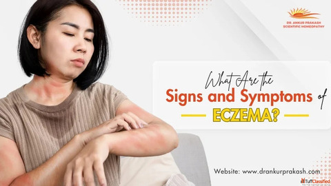 How to Identify the Signs and Symptoms of Eczema