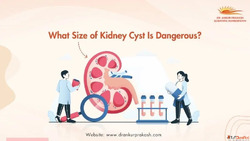 Understanding What Size of Kidney Cyst Is Risky