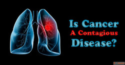 Cancer Facts and Myths Can You Catch Cancer from Someone