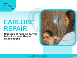 Professional Ear Piercing Hole Repair in Mumbai Clinics