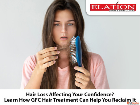 Hair Loss Signs You Shouldn't Ignore - Get Help Today
