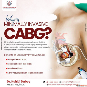 Robotic Surgery in Indore Dr Kshitij Dubey
