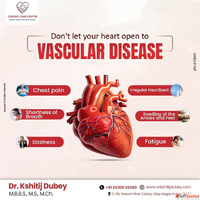 Vascular Surgeries in Indore Dr Kshitij Dubey