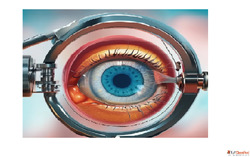 Book Best Eye Oculoplasty Surgery in Indore Today