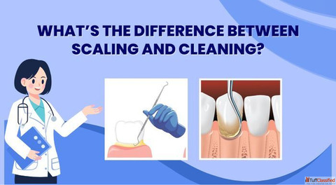 Difference between Scaling and Cleaning