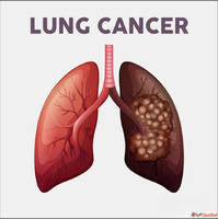 The Role of the Lungs and Issues Related to Lung Cancer