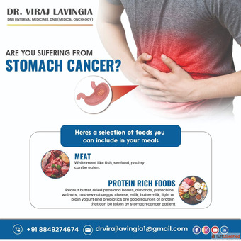 Dr. Viraj Lavingia - Expertise in Stomach Cancer Treatment in India