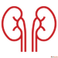 kidney transplant surgery in Trivandrum