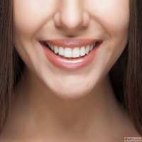 Gingivectomy in Dubai