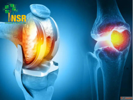 Best Orthopaedic Doctor in Chennai NSR Orthopaedic Wellness Center