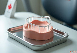 Custom Dental Mouthguards at Revive Dental Canada's Smi...