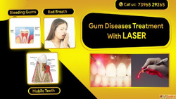 Is Gum Disease Hurting Your Smile We Can Help