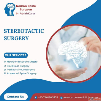 Stereotactic Surgery Precision Neurosurgery at Excel Medi Clinics