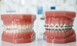 Orthodontics Treatment in Wakad