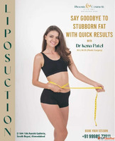 Get Liposuction Surgery in Ahmedabad - Phoenix Cosmetic