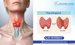 Best Robotic Thyroid Surgeon in Bangalore - Dr. Sumit Talwar